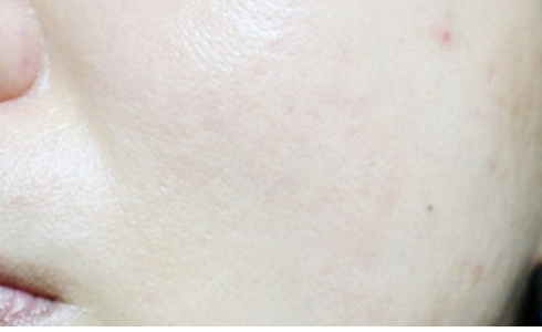 Customer-submitted after photograph associated with DIA Clear Serum