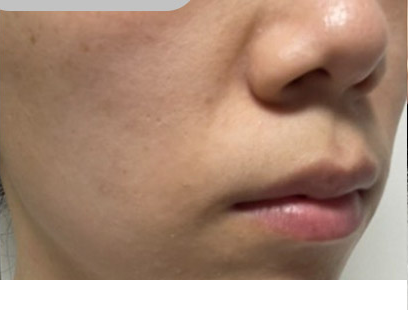 Customer-submitted before photograph associated with DIA Toning Serum