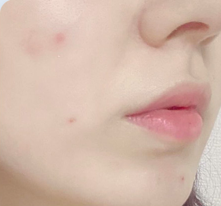 Customer-submitted before photograph associated with Setup Cream [CICA RS]